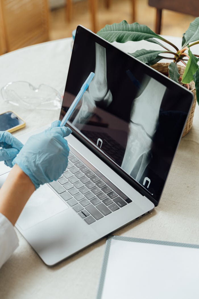 Doctor wearing gloves examines bone X-ray on laptop in a clinical setting.